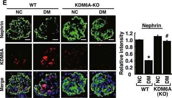Detection of Mouse Nephrin by Immunocytochemistry/Immunofluorescence