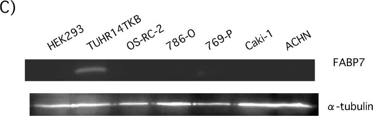Detection of Human FABP7/B-FABP by Western Blot