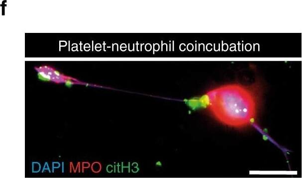 Detection of Mouse Myeloperoxidase/MPO by Immunocytochemistry/Immunofluorescence