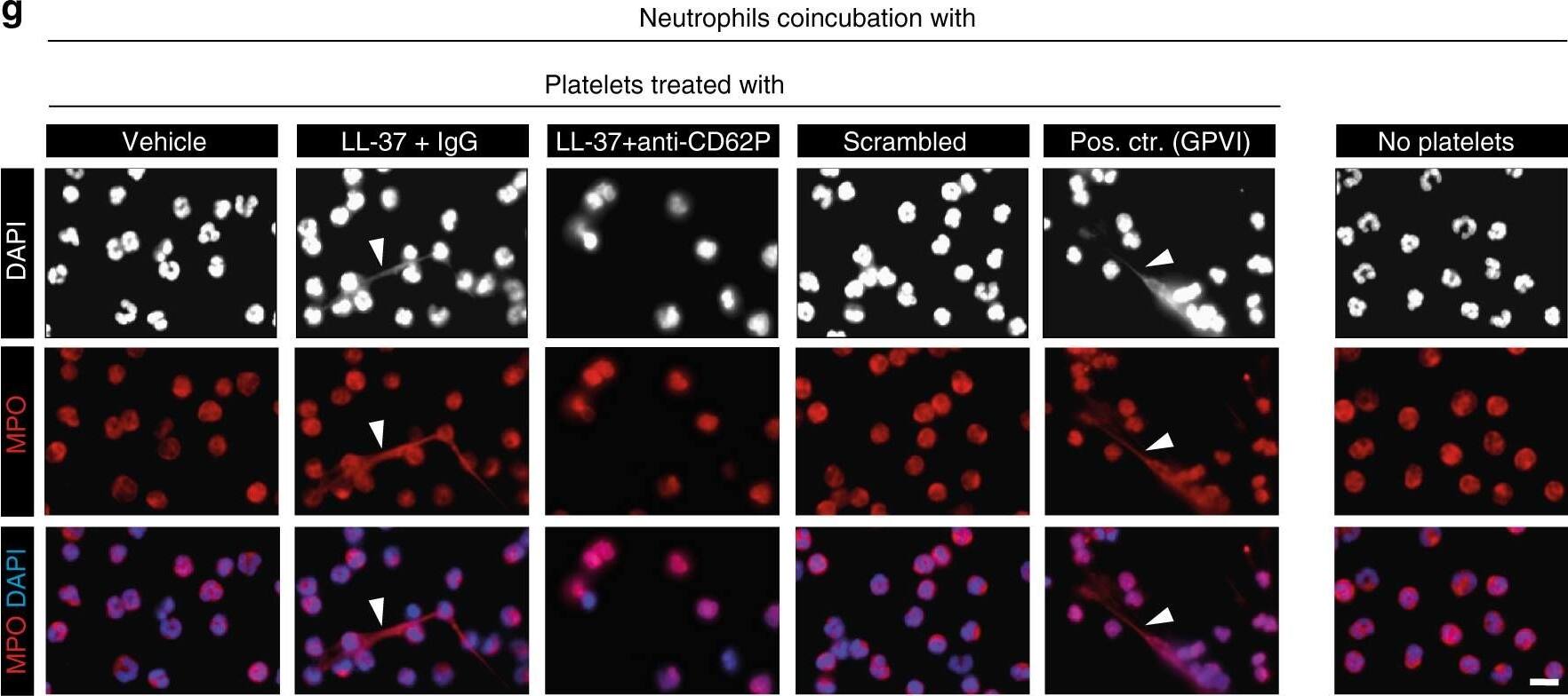 Detection of Mouse Myeloperoxidase/MPO by Immunocytochemistry/Immunofluorescence