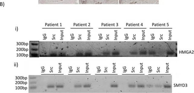 Detection of Human HMGA2 by Western Blot