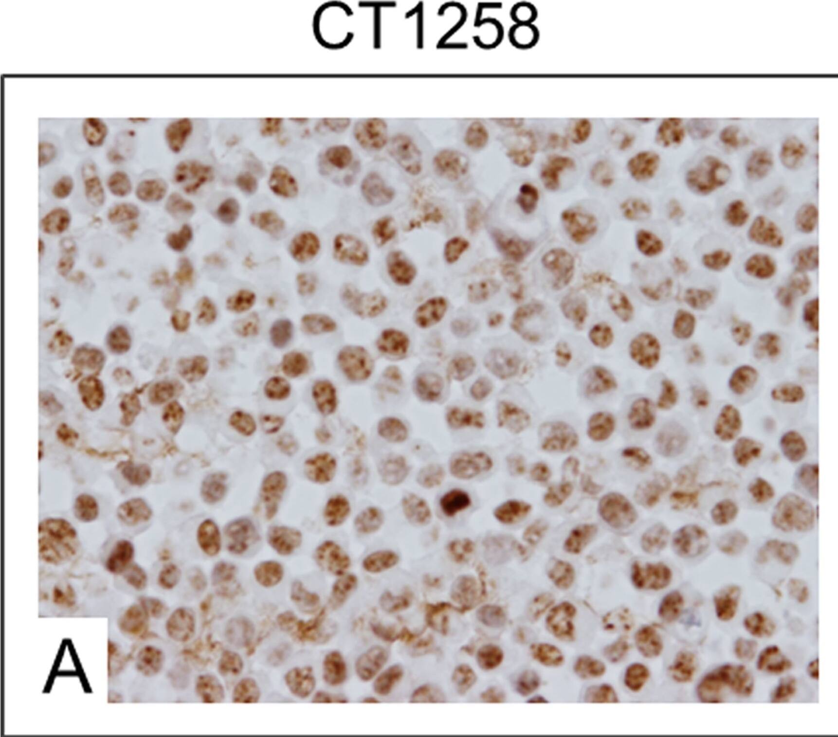 Detection of Canine HMGA2 by Immunocytochemistry/Immunofluorescence
