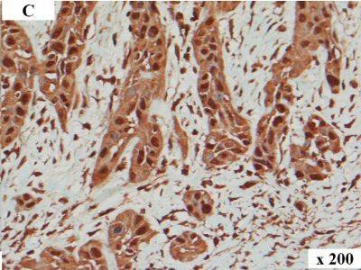 Detection of Human HMGA2 by Immunocytochemistry/Immunofluorescence