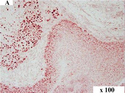 Detection of Canine HMGA2 by Immunocytochemistry/Immunofluorescence