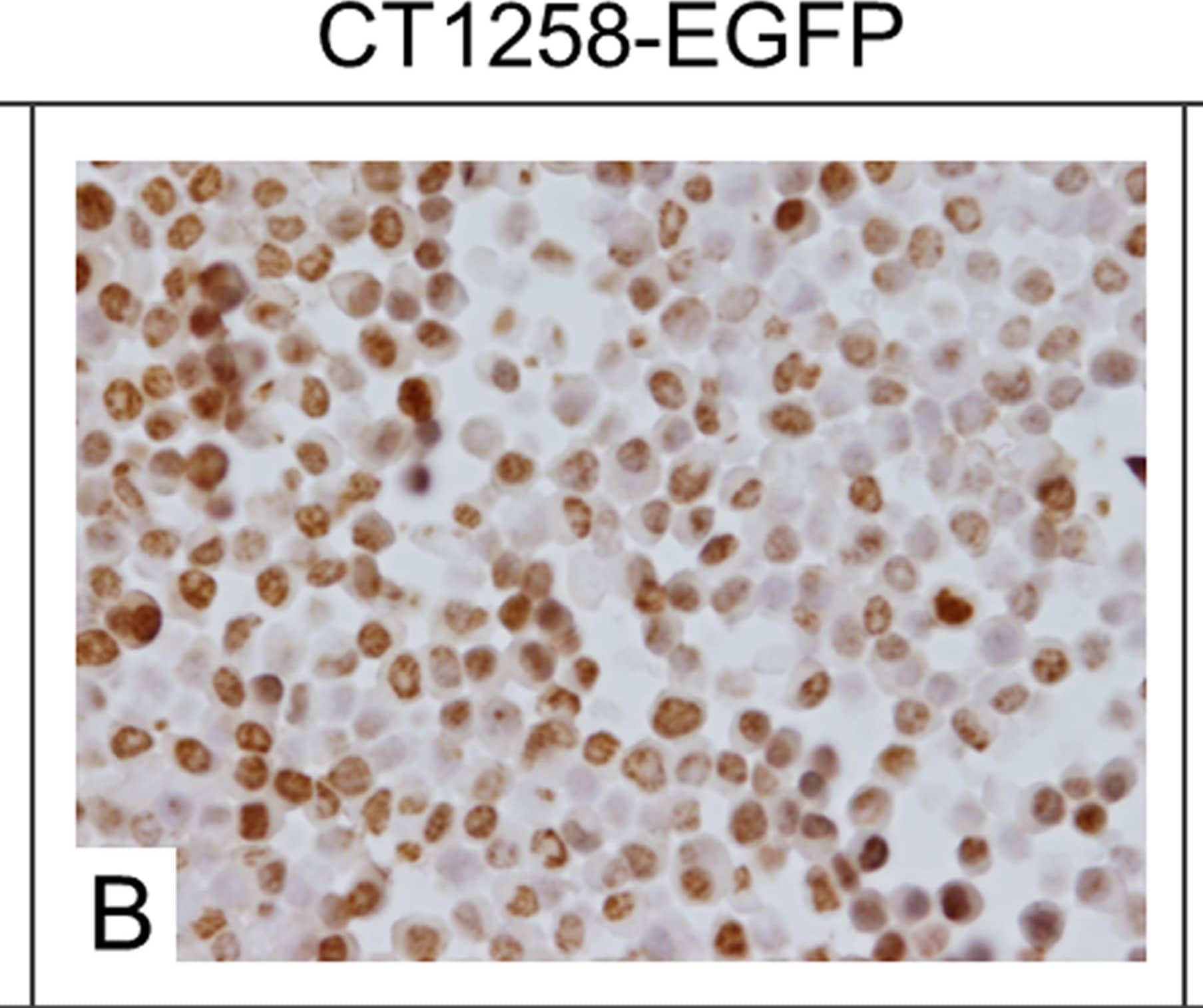 Detection of Human HMGA2 by Immunocytochemistry/Immunofluorescence