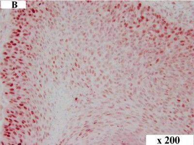 Detection of Canine HMGA2 by Immunocytochemistry/Immunofluorescence