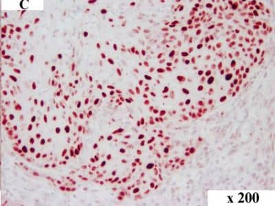 Detection of Canine HMGA2 by Immunocytochemistry/Immunofluorescence