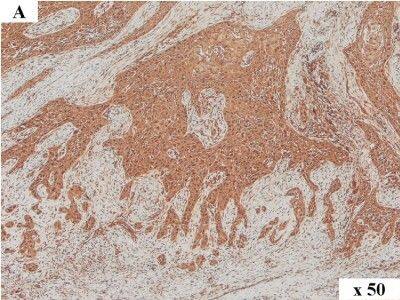 Detection of Human HMGA2 by Immunocytochemistry/Immunofluorescence