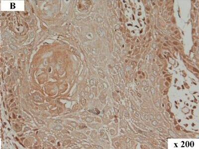 Detection of Human HMGA2 by Immunocytochemistry/Immunofluorescence