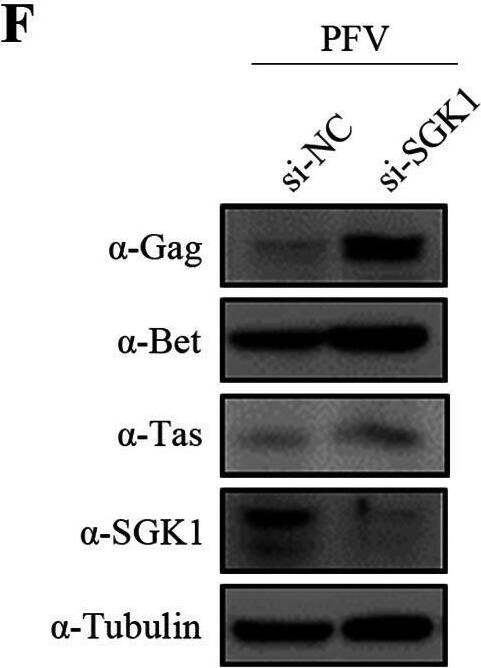 Detection of Human SGK1 by Western Blot