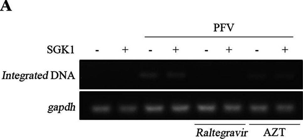 Detection of Human SGK1 by Western Blot
