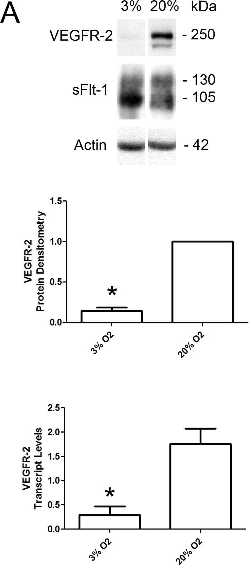 Detection of VEGFR1/Flt-1 by Western Blot