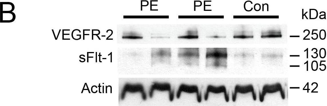 Detection of VEGFR1/Flt-1 by Western Blot