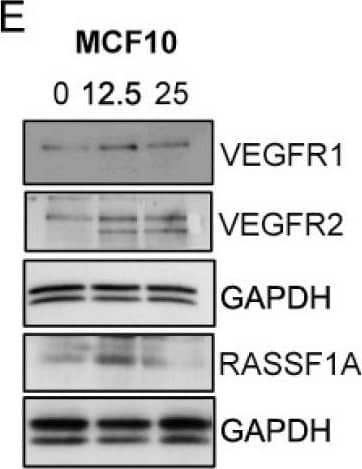 Detection of Human VEGFR1/Flt-1 by Western Blot