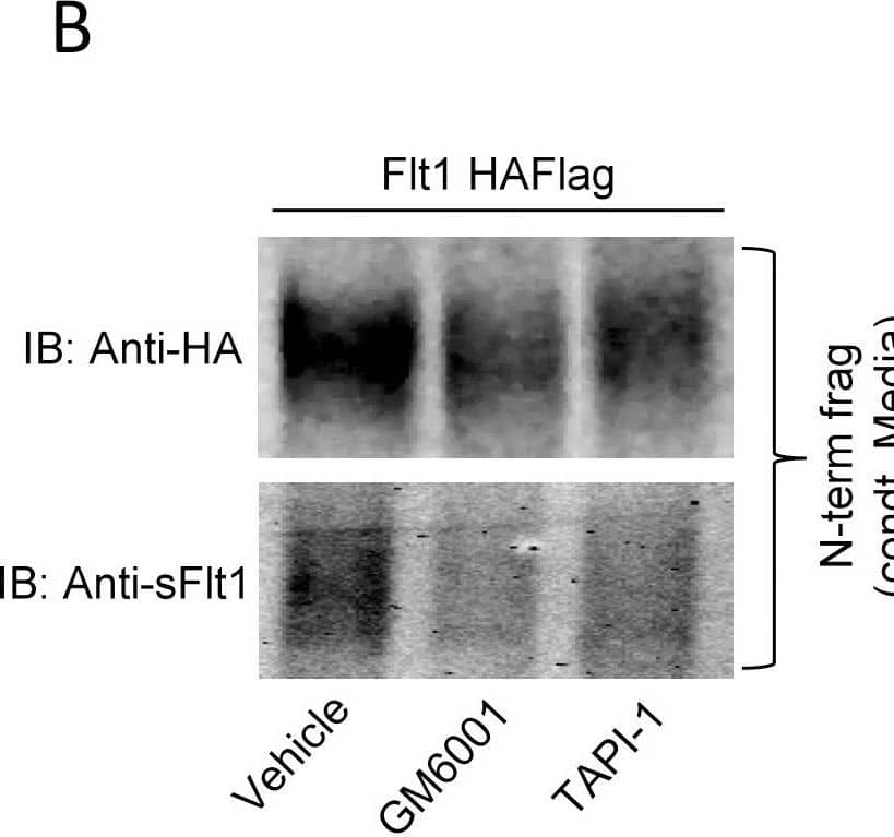 Detection of Human VEGFR1/Flt-1 by Western Blot