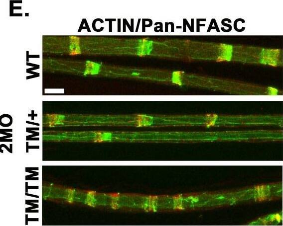 Detection of Mouse Neurofascin by Immunohistochemistry