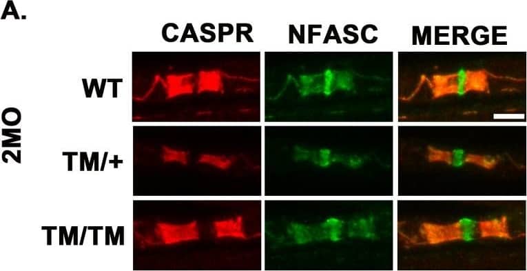 Detection of Mouse Neurofascin by Immunohistochemistry