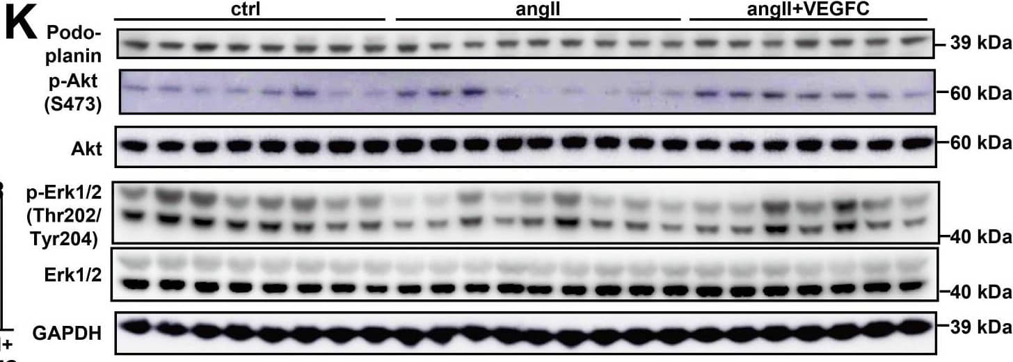 Detection of Mouse Podoplanin by Western Blot