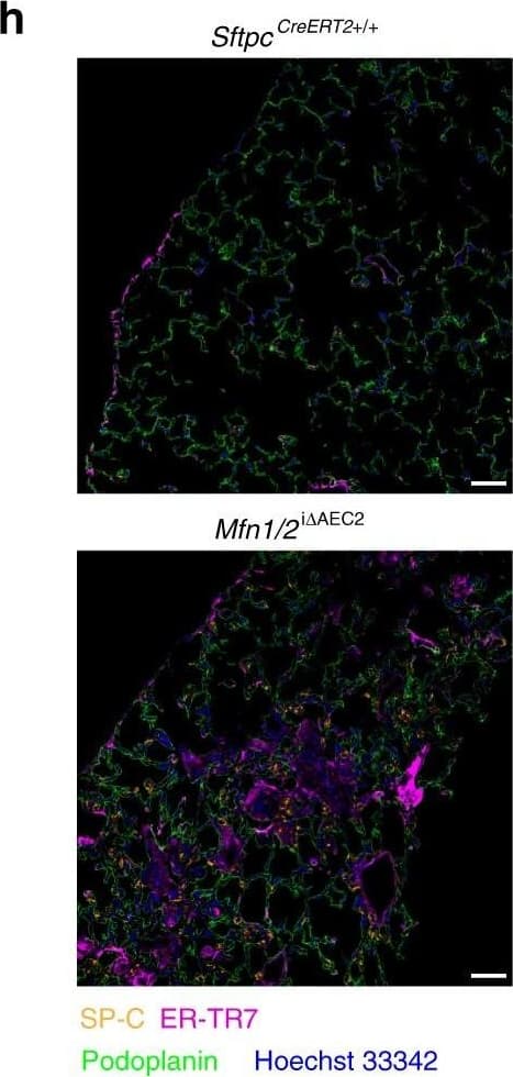 Detection of Mouse Podoplanin by Immunocytochemistry/Immunofluorescence