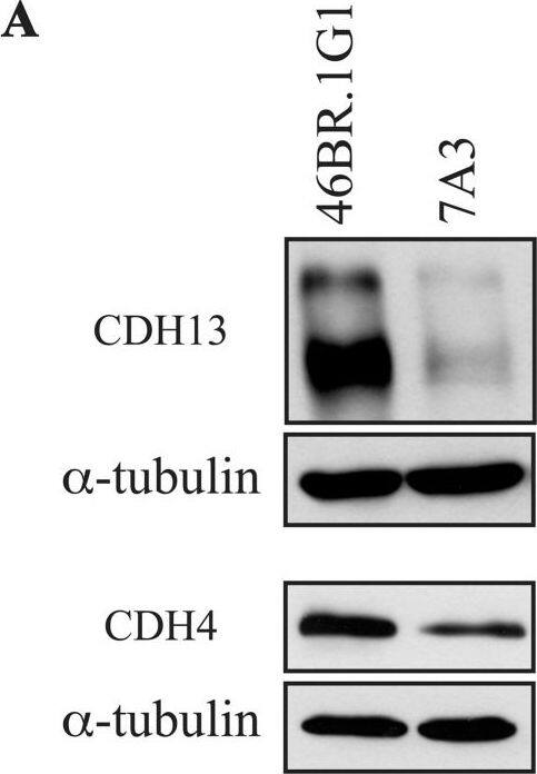 Detection of Human Cadherin-13 by Western Blot