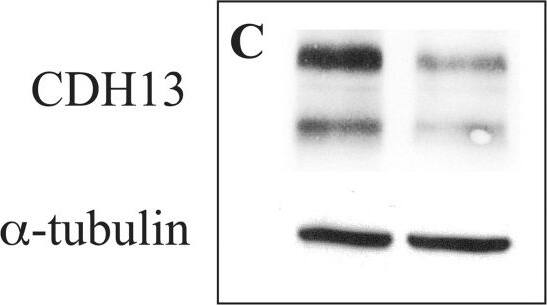 Detection of Human Cadherin-13 by Western Blot