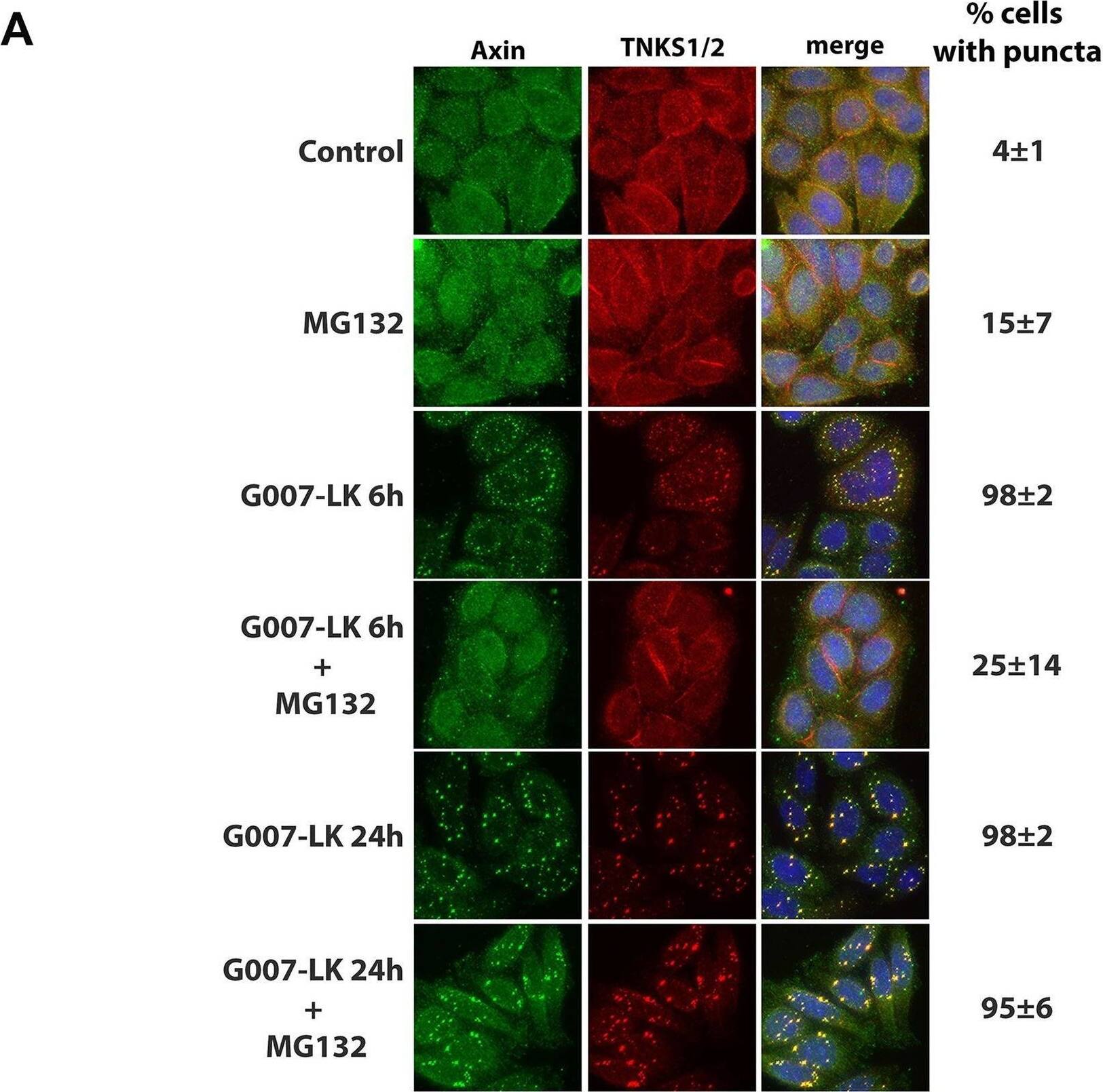 Detection of Axin-1 by Immunocytochemistry/ Immunofluorescence