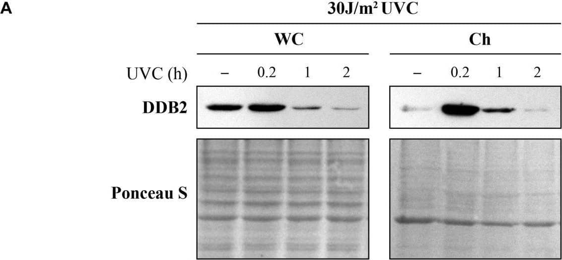 Detection of XPE/DDB2 by Western Blot