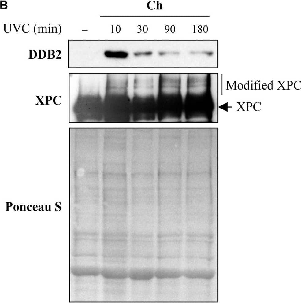 Detection of XPE/DDB2 by Western Blot