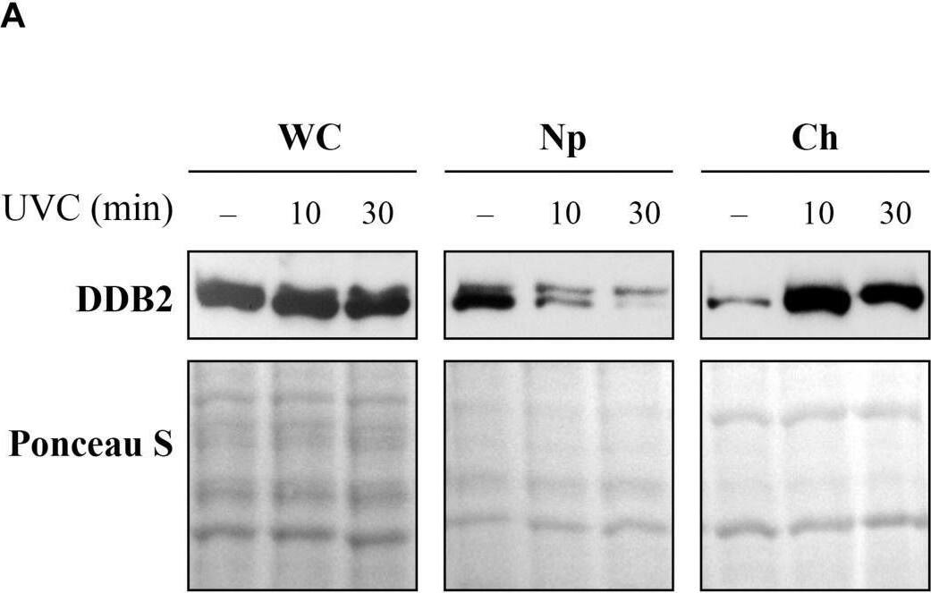 Detection of XPE/DDB2 by Western Blot