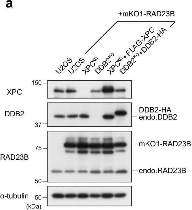 Detection of XPE/DDB2 by Western Blot