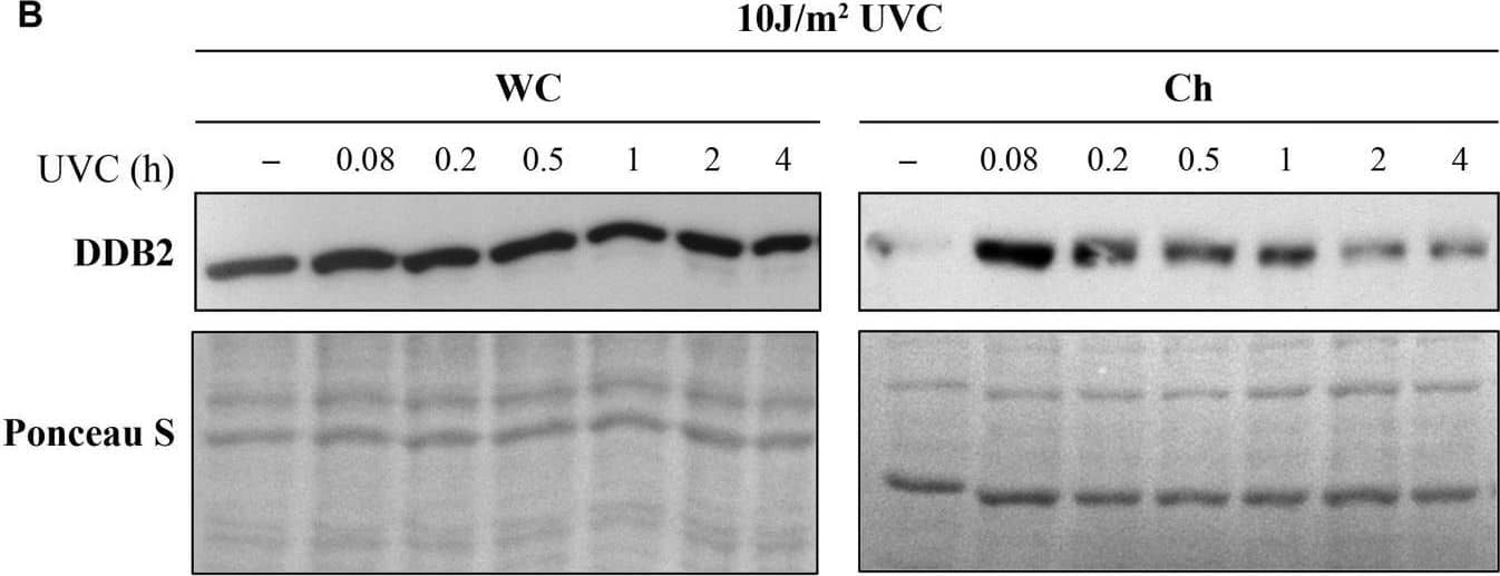 Detection of XPE/DDB2 by Western Blot