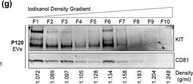 Detection of CD117/c-kit by Western Blot