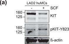 Detection of CD117/c-kit by Western Blot