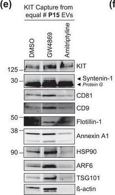 Detection of CD117/c-kit by Western Blot