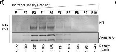 Detection of CD117/c-kit by Western Blot
