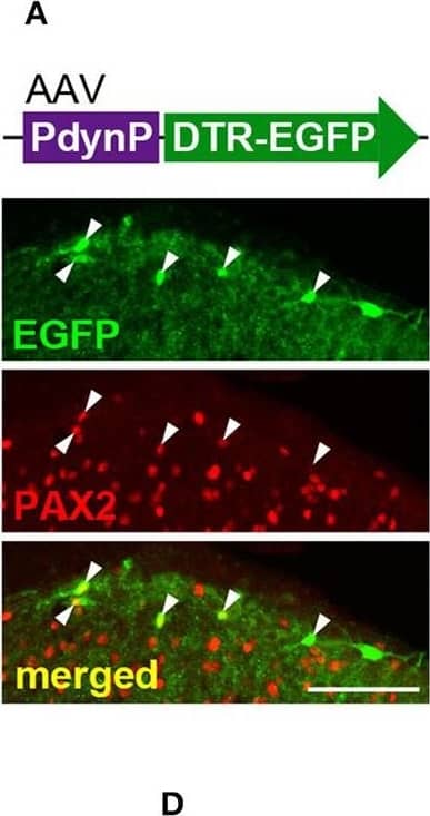 Detection of Rat Human Pax2 Antibody by Immunohistochemistry