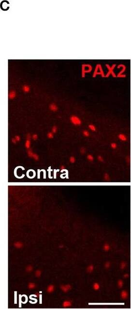 Detection of Rat Human Pax2 Antibody by Immunohistochemistry