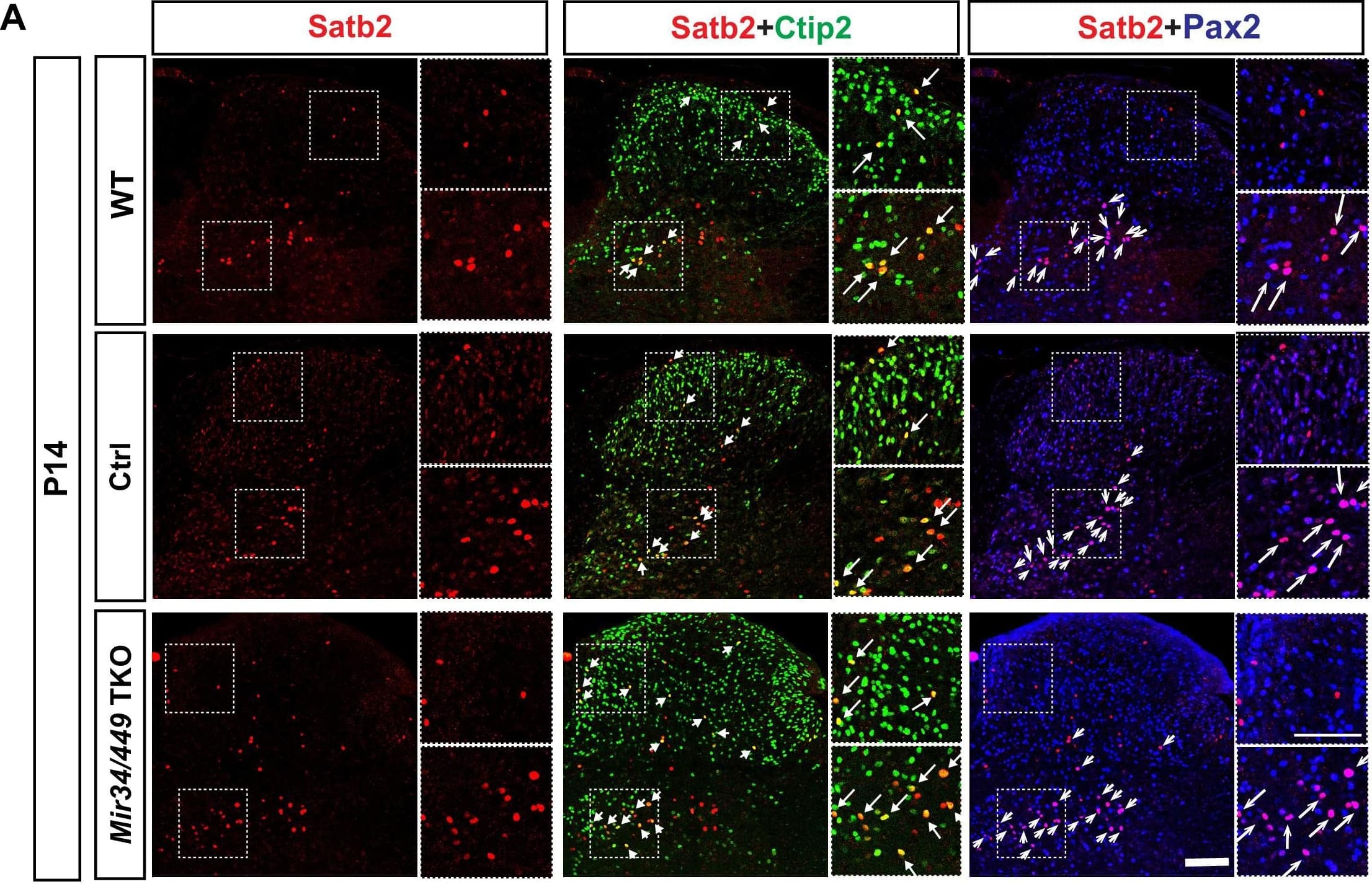 Detection of Mouse Pax2 by Immunohistochemistry