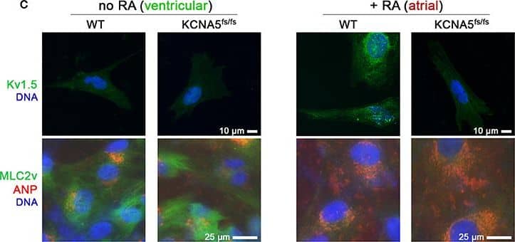 Detection of Human Atrial Natriuretic Peptide/ANP by Immunocytochemistry/Immunofluorescence
