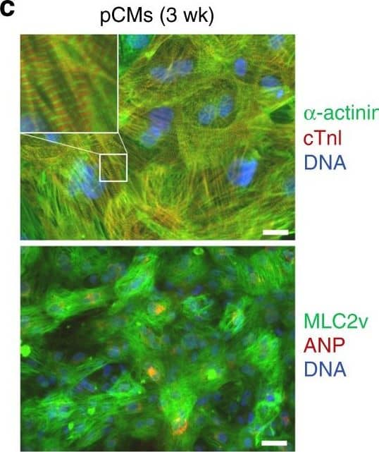 Detection of Human Atrial Natriuretic Peptide/ANP by Immunocytochemistry/Immunofluorescence