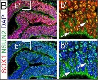 Detection of Human SOX1 by Immunocytochemistry/Immunofluorescence