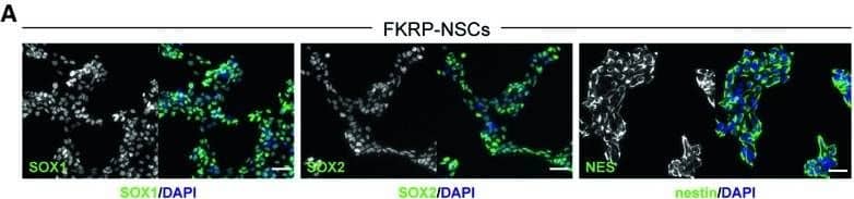 Detection of Human SOX1 by Immunocytochemistry/Immunofluorescence