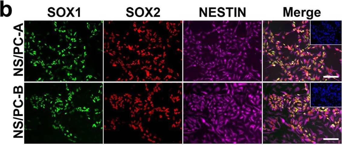 Detection of Human SOX1 by Immunocytochemistry/ Immunofluorescence