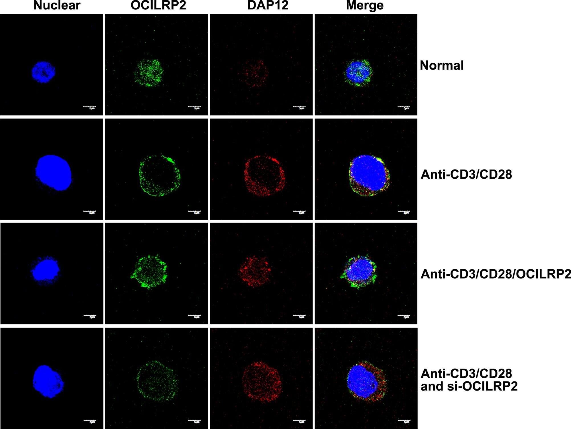 Detection of Mouse OCILRP2/CLEC2i by Immunocytochemistry/Immunofluorescence