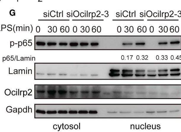 Detection of OCILRP2/CLEC2i by Western Blot