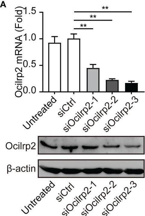 Detection of OCILRP2/CLEC2i by Western Blot