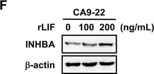 Detection of Activin A  betaA subunit by Western Blot