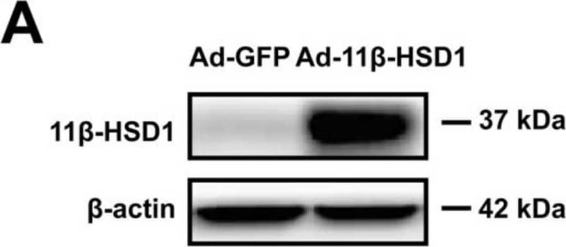 Detection of 11 beta-HSD1 by Western Blot