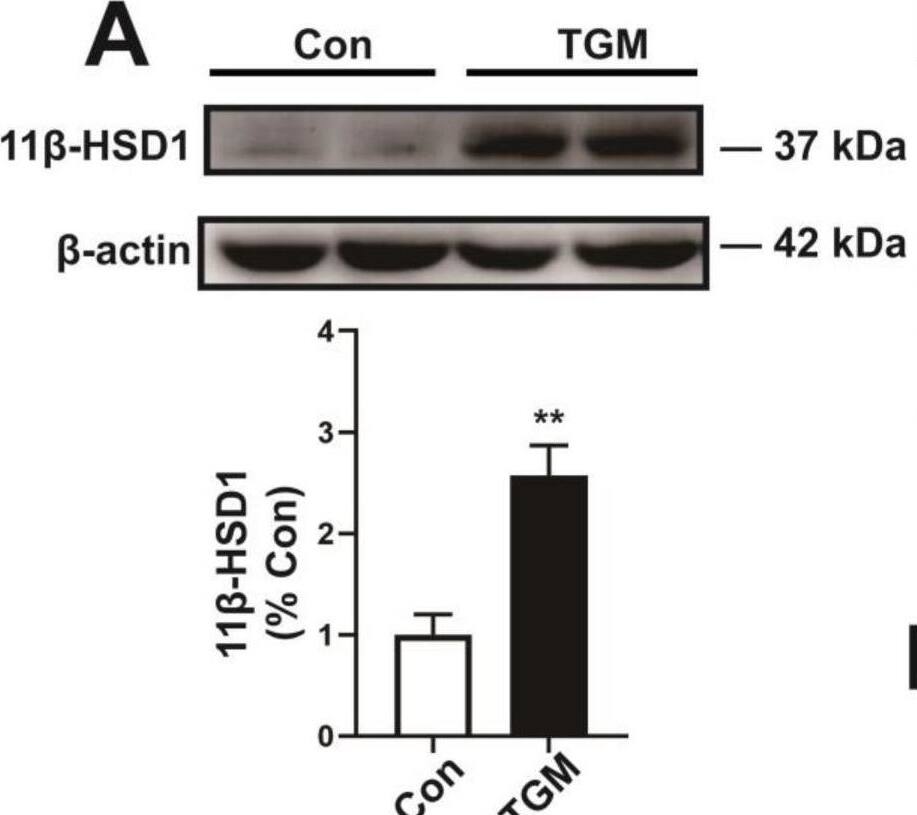 Detection of 11 beta-HSD1 by Western Blot
