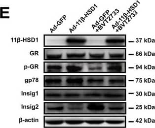 Detection of 11 beta-HSD1 by Western Blot